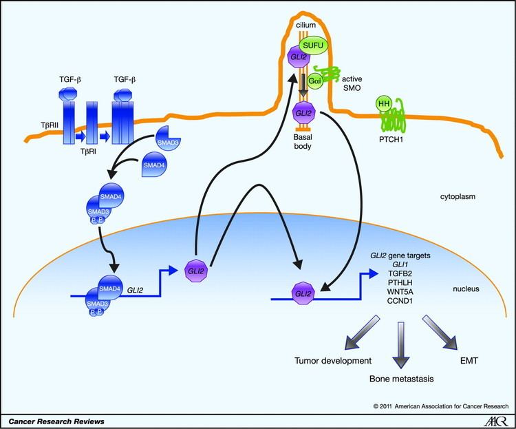 GLI2 TGFSMADGLI2 Signaling Axis in Cancer Progression and Metastasis