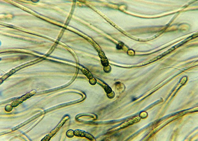 Gloeotrichia Gloeotrichia Filament contains heterocytes Landcare Research
