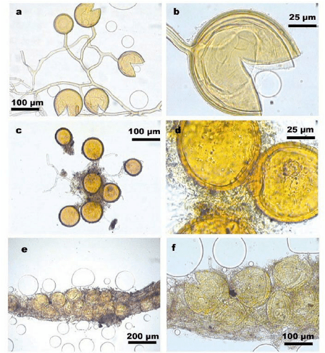 Glomus (fungus) Glomus (fungus)