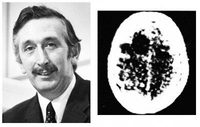 Godfrey Hounsfield The Evolution of CT Scan Clinical Trials BioClinica