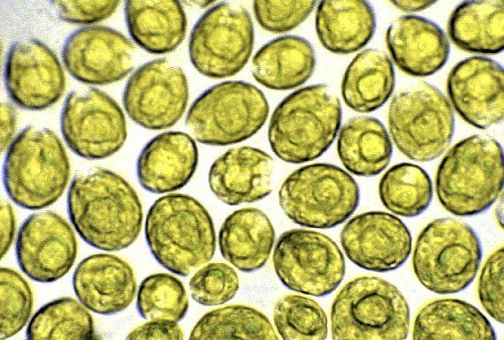 Golden algae BOTANYcz Invisible Life 2 BLUEGREEN ALGAE and GREEN AND GOLDEN