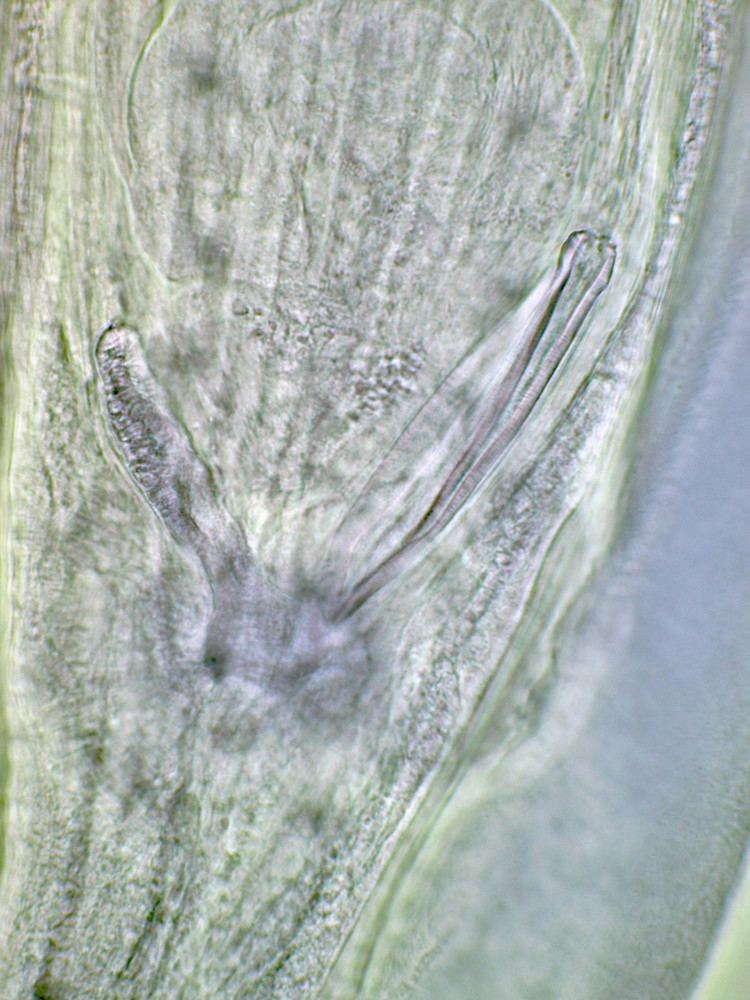 Gongylonema FileGongylonema pulchrum nematode from man Figure 2fjpg