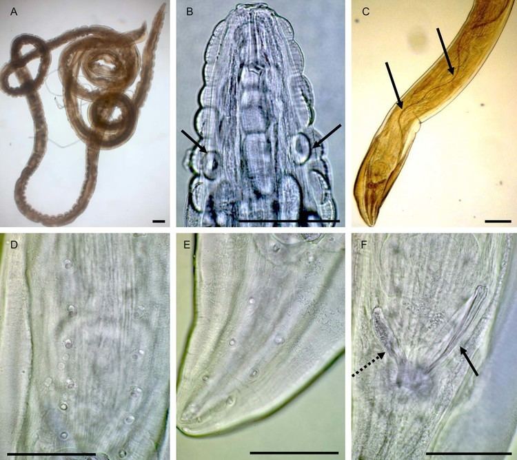 Gongylonema FileGongylonema pulchrum nematode from man Full Plate 2jpg