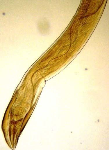Gongylonema pulchrum FileGongylonema pulchrum nematode from man Figure 2cjpg