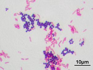 Gram-positive bacteria Grampozitivna bakterija Wikiwand