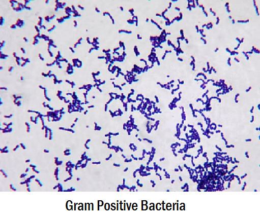 Gram-positive bacteria Differences Between Gram Positive and Gram Negative Bacteria
