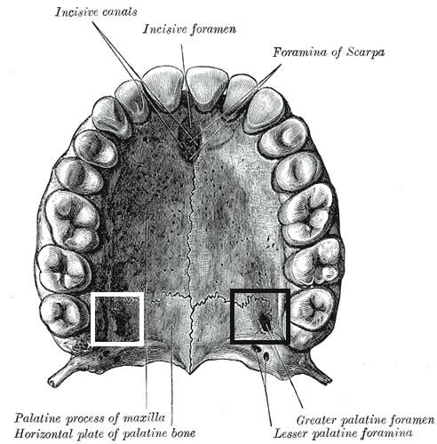 Greater palatine foramen
