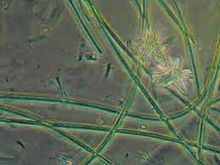 Phylum chlorobi, composed of green sulfur bacteria that are categorized as photolithotrophic oxidizers of sulfur.