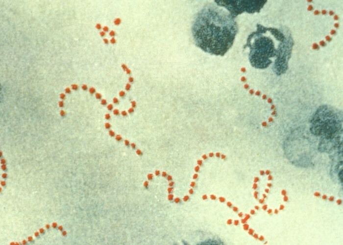 Group A streptococcal infection