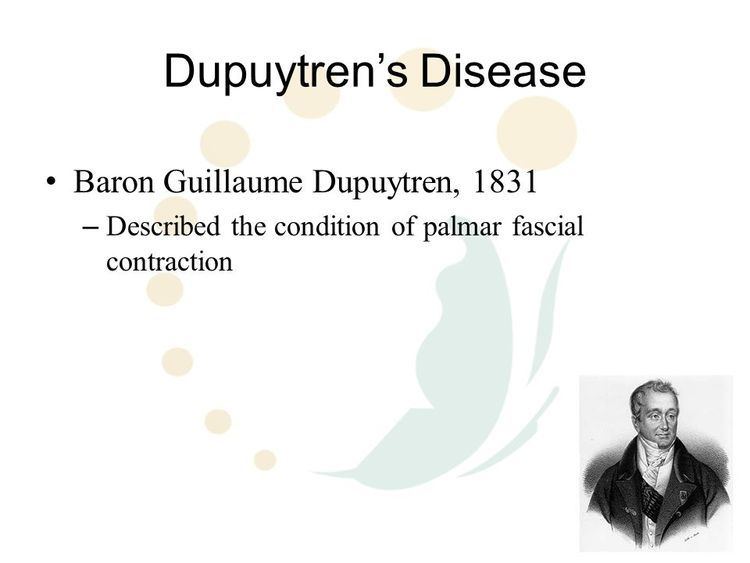 Guillaume Dupuytren Dupuytrens Disease Baron Guillaume Dupuytren ppt video online download