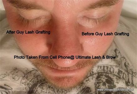 Guy Lash ultimate lash brow ULB Guy Lash Grafting