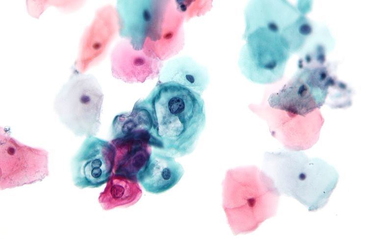 Gynaecologic cytology