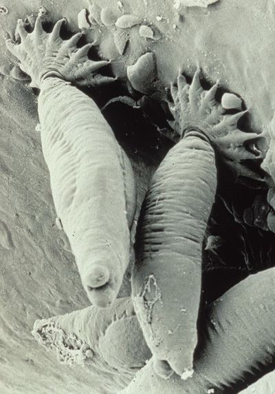 Gyrodactylus salaris Gyrodactylosis