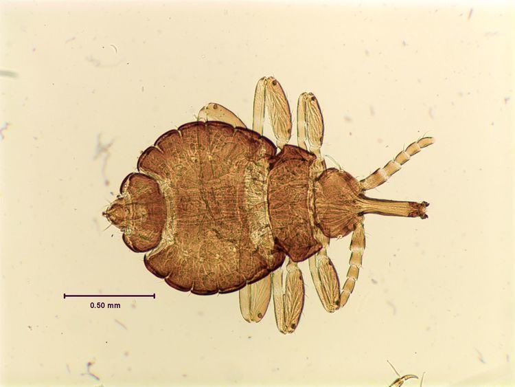 Haematomyzus Lice Phthirapterainfo