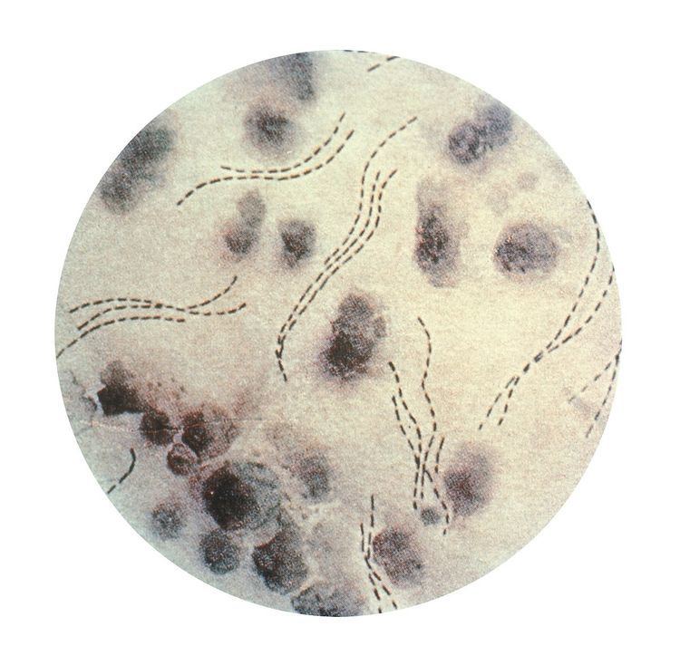 бактерия возбудитель мягкого шанкра