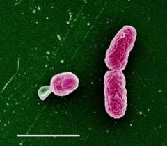 Haemophilus influenzae biogroup aegyptius httpsoquizletcomiSz1u5dzxK9q2pQ1n6llgmjpg