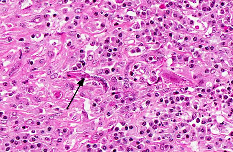 Halicephalobus gingivalis Conference 03 2012 Case 01 20121003