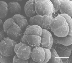 Halococcus Scanning electron micrograph of Halococcus salifodinae Br3