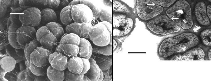 Halococcus Properties of Halococcus salifodinae an Isolate from Permian Rock