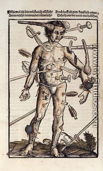 Hans von Gersdorff XVIIIv The Wound Man from the Feldtbuch der Wundartzney by Hans von