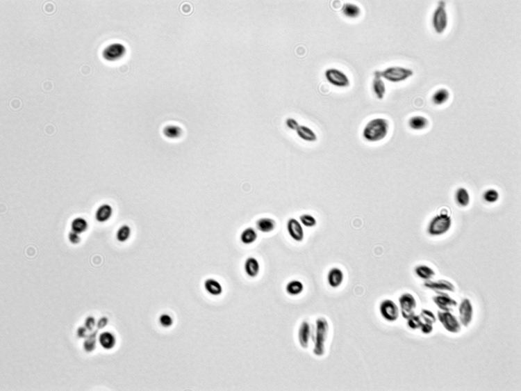 Hanseniaspora 1000 images about Yeasts and alcohol on Pinterest Blog Beer and