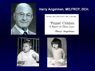 Harry Angelman Angelman Syndrome history of Harry Angelman Audrey Angelman UBE3A