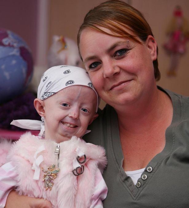 Hayley Okines Hayley Okines Courageous teen who died of rare ageing condition