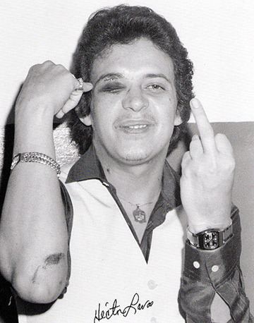 Héctor Lavoe smiling in spite of having a black eye and showing an offensive hand gesture