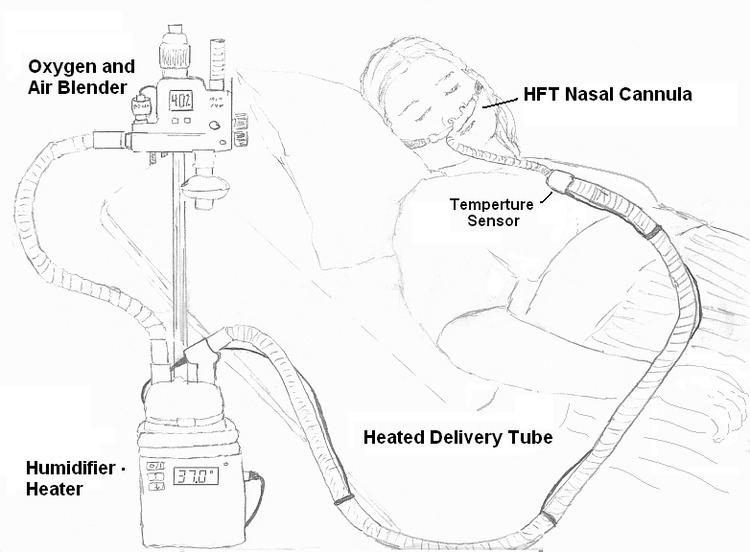 Heated humidified high-flow therapy