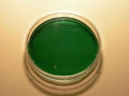 Hektoen enteric agar Hektoen Enteric Agar Microbiology Food and Drug Reference