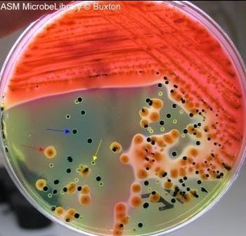 Hektoen enteric agar Hektoen Enteric HE Agar composition principle and uses