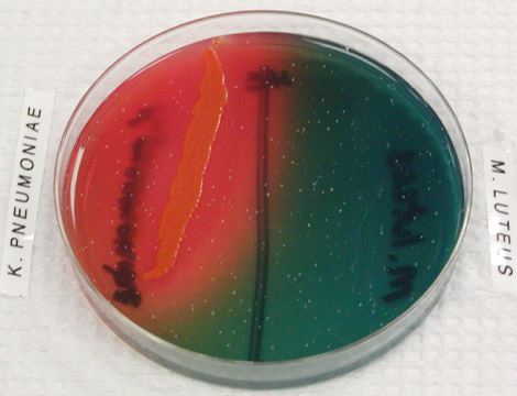 Hektoen enteric agar wwwaustinccedumicrobugzimagesHESalmjpg