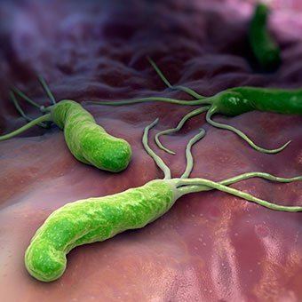 Helicobacter H pylori Helicobacter Pylori Infection Symptoms Treatment