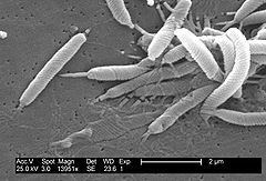Helicobacter httpsuploadwikimediaorgwikipediacommonsthu