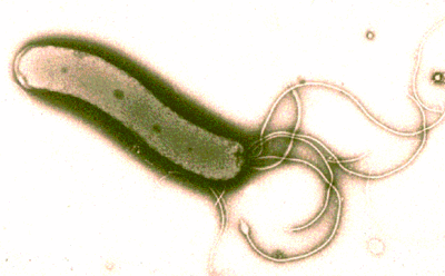 Helicobacter Helicobacter MicrobeWiki
