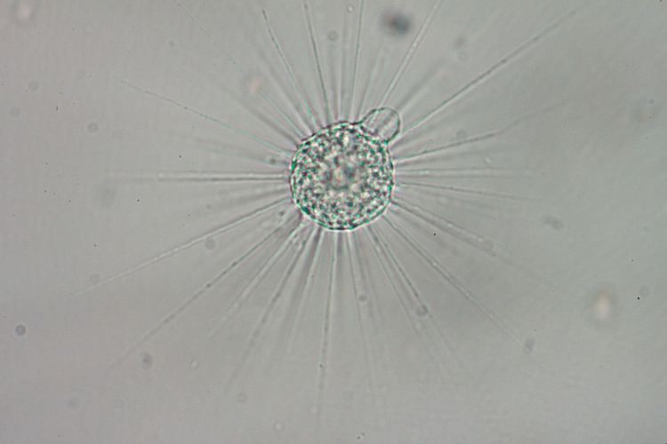 Heliozoa Heliozoa Macro in photographyonthenet forums
