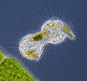 Heliozoa MicUK Sun animalcules and amoebas