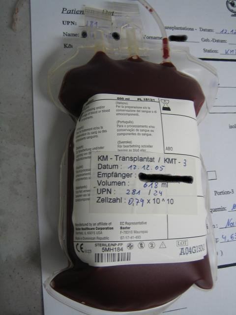 Hematopoietic stem cell transplantation