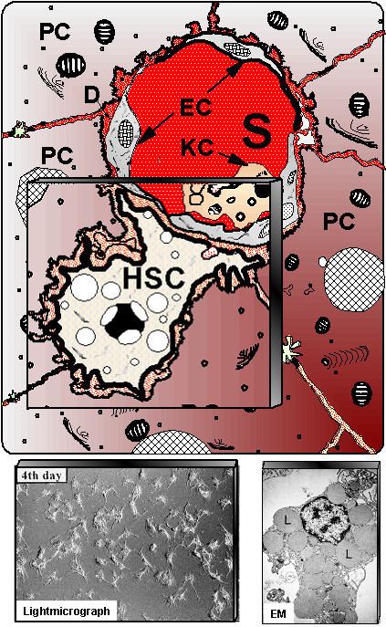 Hepatic stellate cell