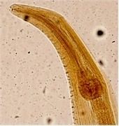 Heterakis parasitipedianetimagesstoriesendoparaNematod