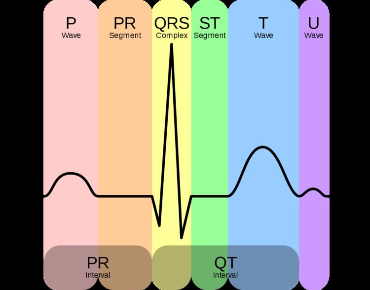 High Frequency QRS