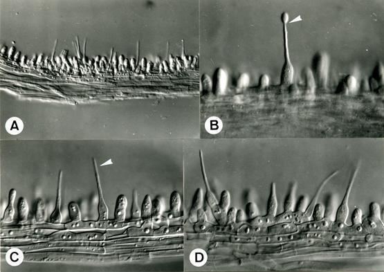 Hirsutella Anamorphic fungi gtgt Anamorphic fungi gtgt Anamorphic fungi