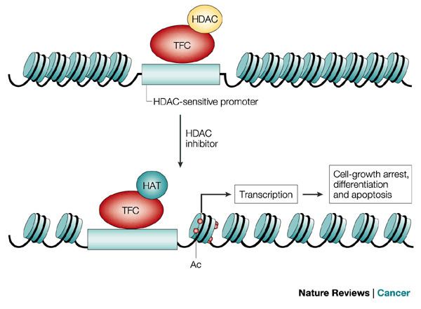 Histone deacetylase Figure 2 Histone deacetylases and cancer causes and therapies