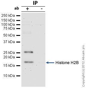 Histone H2B AntiHistone H2B antibody ab52484 ChIP Grade Abcam