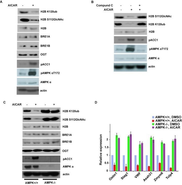 Histone H2B Activation of AMPK can suppress histone H2B OGlcNAcylation A