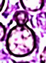Histoplasma duboisii wwwhistopathologyindianethdub11jpg