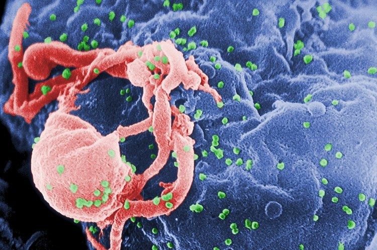 History of HIV/AIDS