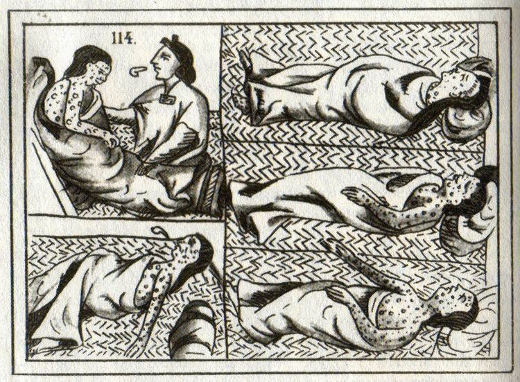 History of smallpox in Mexico