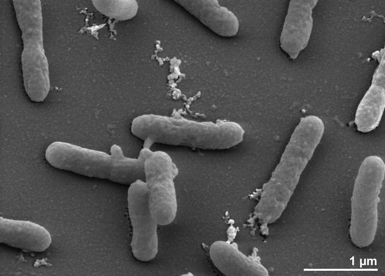 Holophaga foetida standardsingenomicsorgcontent62174sigs27460