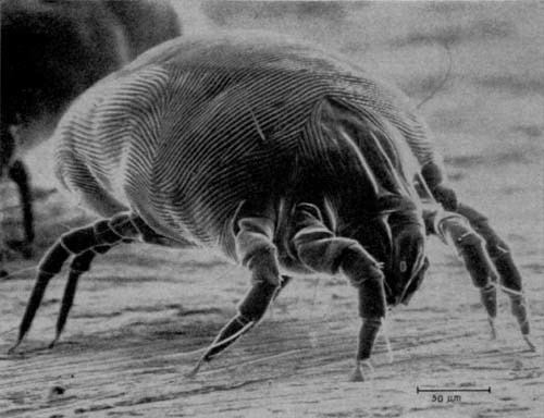 House dust mite House dust mite Wikipedia